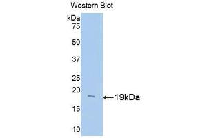 Western blot analysis of the recombinant protein. (UCP2 Antikörper  (AA 150-304))