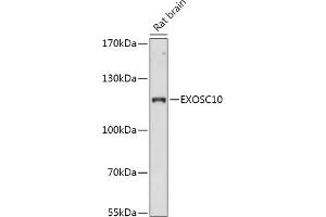 Western blot analysis of extracts of Rat brain, using EXOSC10 antibody (ABIN7267062) at 1:1000 dilution. (EXOSC10 Antikörper  (AA 586-885))