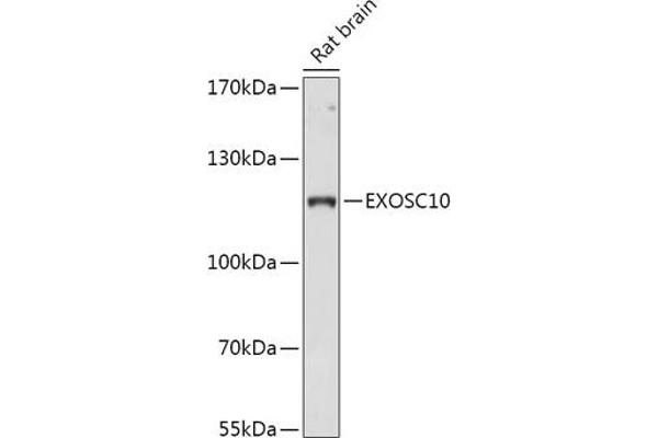 EXOSC10 anticorps  (AA 586-885)