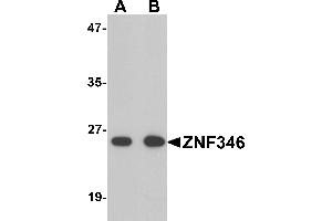 Western blot analysis of TRIP6 in EL4 cell lysate with TRIP6 antibody at 1 µg/mL. (ZNF346 Antikörper  (N-Term))