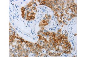 Immunohistochemistry (IHC) image for anti-Pyrimidinergic Receptor P2Y, G-Protein Coupled, 4 (P2RY4) (AA 286-365) antibody (ABIN3017282)