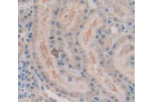 IHC-P analysis of Rat Tissue, with DAB staining. (Androgen Receptor Antikörper  (AA 765-902))