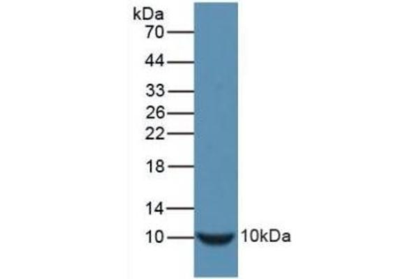 Insulin Antikörper  (AA 90-110)