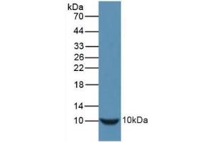 Detection of Recombinant INS, Mouse using Polyclonal Antibody to Insulin (INS)