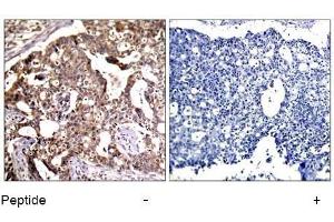 Image no. 1 for anti-Mitogen-Activated Protein Kinase Kinase 4 (MAP2K4) (Ser80) antibody (ABIN197325) (MAP2K4 Antikörper  (Ser80))