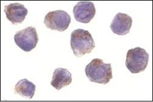 Immunocytochemistry of RICK in A431 cells with this product at 10 μg/ml. (RIPK2 Antikörper  (N-Term))