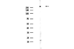 Western blot analysis of lysates from PC12 cells(UV,30 min treatment), using ITPR2 Antibody at 1/1000 dilution.