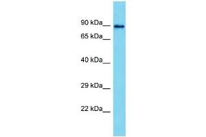 Host: Rabbit  Target Name: Mapk8ip2  Sample Tissue: Rat Testis lysates  Antibody Dilution: 1. (IB2 Antikörper  (Middle Region))