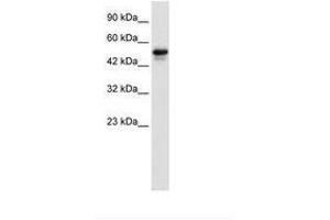 Image no. 1 for anti-SET Domain Containing 4 (SETD4) (AA 342-391) antibody (ABIN6735922) (SETD4 Antikörper  (AA 342-391))