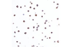 Immunocytochemistry (ICC) image for anti-HLA-DR-gamma (CD74) antibody (ABIN7449435) (CD74 Antikörper)