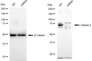 Western blotting analysis using Calpain 2 antibody (ABIN7797847). (Rekombinanter Calpain 2 Antikörper)