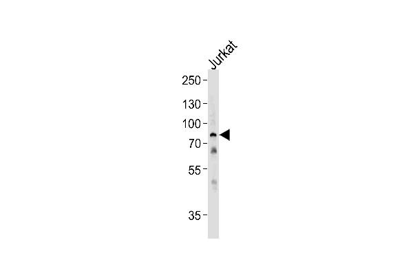 HSPA6 Antikörper  (C-Term)