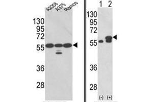 (LEFT) Western blot analysis of PDIA3 Antibody (Center) in A2058, A375, Ramos cell line lysates (35ug/lane). (PDIA3 Antikörper  (Middle Region))