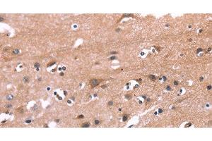 Immunohistochemistry of paraffin-embedded Human brain tissue using PIP5K1B Polyclonal Antibody at dilution 1:30 (PIP5K1B Antikörper)