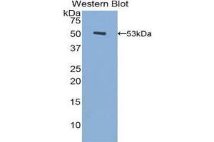 Detection of Recombinant FGB, Human using Polyclonal Antibody to Fibrinogen Beta Chain (FGB) (Fibrinogen beta Chain Antikörper  (AA 45-491))