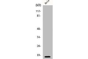 Western Blot analysis of HeLa cells using p16 Polyclonal Antibody (CDKN2A Antikörper  (N-Term))
