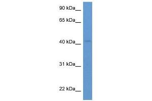 Western Blot showing HSH2D antibody used at a concentration of 1-2 ug/ml to detect its target protein.