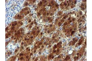 Image no. 3 for anti-NQO2 (NQO2) antibody (ABIN1499816)