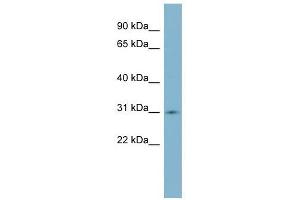 SCO1 antibody used at 1 ug/ml to detect target protein. (SCO1 Antikörper)
