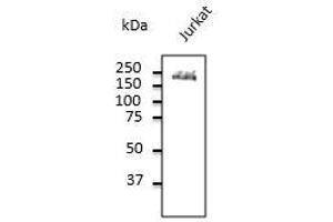 Endogenous CD45 detected with at 1/500 dilution, Iysate at 100 µg per Iane and rabbit polyclonal to goat lgG (HRP) at 1/10,000 dilution. (CD45 Antikörper  (C-Term))