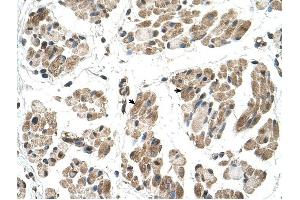 FKTN antibody was used for immunohistochemistry at a concentration of 4-8 ug/ml to stain Skeletal muscle cells (arrows) in Human Muscle. (Fukutin Antikörper  (N-Term))