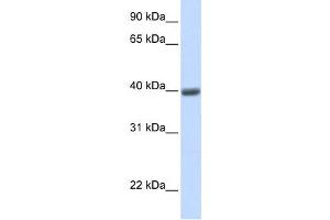 Western Blotting (WB) image for anti-Melanoma Antigen Family A, 1 (Directs Expression of Antigen MZ2-E) (MAGEA1) antibody (ABIN2458988) (MAGEA1 Antikörper)