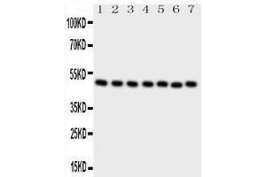 Western Blotting (WB) image for anti-C-terminal Binding Protein 2 (CTBP2) (AA 429-445), (C-Term) antibody (ABIN3044439) (CTBP2 Antikörper  (C-Term))