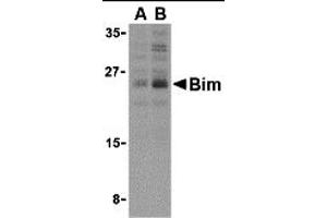 Western Blotting (WB) image for anti-BCL2-Like 11 (Apoptosis Facilitator) (BCL2L11) (Middle Region 2) antibody (ABIN1031197) (BIM Antikörper  (Middle Region 2))
