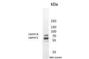 Image no. 2 for anti-Lamin A/C (LMNA) antibody (ABIN959427) (Lamin A/C Antikörper)