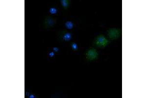 Image no. 2 for anti-NADH Dehydrogenase (Ubiquinone) 1 beta Subcomplex, 10, 22kDa (NDUFB10) antibody (ABIN1499671) (NDUFB10 Antikörper)