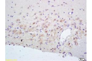 Formalin-fixed and paraffin embedded rat brain labeled with Rabbit Anti NR2A/NMDAR2A Polyclonal Antibody, Unconjugated (ABIN747353) at 1:200 followed by conjugation to the secondary antibody and DAB staining (NMDAR2A Antikörper  (AA 851-950))