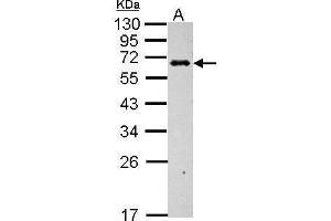 WB Image Sample (30 ug of whole cell lysate) A: BCL-1 12% SDS PAGE antibody diluted at 1:1000 (C4BPB Antikörper)