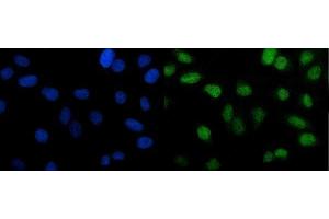 IF analysis of PTBP2 using anti-PTBP2 antibody (ABIN7599454).