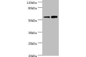Western blot All lanes: Non-syndromic hearing impairment protein 5 antibody at 10 μg/mL Lane 1: Hela whole cell lysate Lane 2: HepG2 whole cell lysate Secondary Goat polyclonal to rabbit IgG at 1/10000 dilution Predicted band size: 55, 11, 37 kDa Observed band size: 55 kDa (Non-Syndromic Hearing Impairment Protein 5 (GSDME) (AA 1-260) Antikörper)