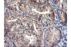 Image no. 10 for anti-F-Box Protein 21 (FBXO21) antibody (ABIN1498232) (FBXO21 Antikörper)