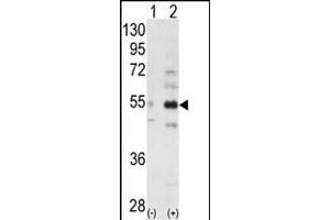 Western blot analysis of ALS2CR2 (arrow) using ALS2CR2 Antibody (C-term ) (ABIN391172 and ABIN2841272). (STRADB Antikörper  (C-Term))