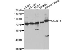 Western blot analysis of extracts of various cell lines, using GALNT3 antibody. (GALNT3 Antikörper)