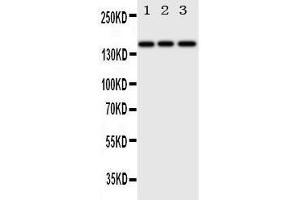 Anti-ErbB 4 antibody, Western blotting Lane 1: HELA Cell Lysate Lane 2: U87 Cell Lysate Lane 3: NEURO Cell Lysate (ERBB4 Antikörper  (N-Term))