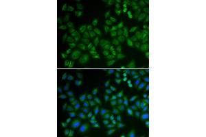 Immunofluorescence analysis of HeLa cells using SMPD1 antibody (ABIN5974079). (SMPD1 Antikörper)