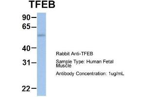 Host: Rabbit  Target Name: TFEB  Sample Tissue: Human Fetal Muscle  Antibody Dilution: 1. (TFEB Antikörper  (Middle Region))