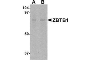 Western blot analysis of ZBTB1 in HepG2 lysate with this product at (A) 1 and (B) 2 μg/ml. (ZBTB1 Antikörper  (Center))