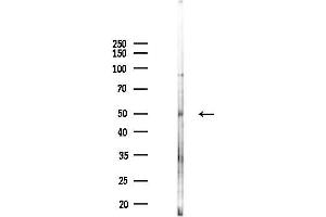 Western blot analysis of lysates from HUVEC cells(UV,30 min treatment), using MLKL Antibody at 1/1000 dilution.
