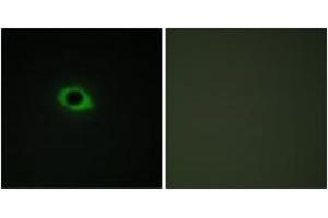 Immunofluorescence analysis of COS7 cells, using TENS3 Antibody. (TNS3 Antikörper  (AA 541-590))
