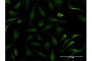 Immunofluorescence of monoclonal antibody to PER2 on HeLa cell. (PER2 Antikörper  (AA 1-100))