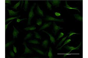 Immunofluorescence of monoclonal antibody to PER2 on HeLa cell. (PER2 Antikörper  (AA 1-100))