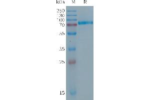 Human (50-609) Protein, His Tag on SDS-PAGE under reducing condition.
