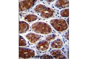 CPSF3L Antibody immunohistochemistry analysis in formalin fixed and paraffin embedded human stomach tissue followed by peroxidase conjugation of the secondary antibody and DAB staining. (CPSF3L Antikörper  (N-Term))