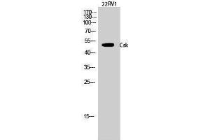 Western Blotting (WB) image for anti-C-Src tyrosine Kinase (CSK) (Ser280) antibody (ABIN3184105) (CSK Antikörper  (Ser280))