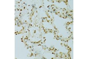 Immunohistochemistry of paraffin-embedded rat lung using RCC1 antibody (ABIN5973761) at dilution of 1/100 (40x lens). (RCC1 Antikörper)