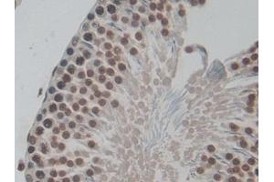 Detection of H3 in Rat Testis Tissue using Polyclonal Antibody to Histone H3 (H3) (Histone 3 Antikörper  (AA 1-136))